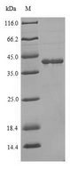 LHCGR / LHR / LH Receptor Protein - (Tris-Glycine gel) Discontinuous SDS-PAGE (reduced) with 5% enrichment gel and 15% separation gel.