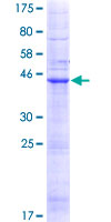 LHFP Protein - 12.5% SDS-PAGE of human LHFP stained with Coomassie Blue