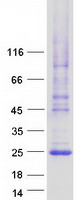 LHFPL3 Protein - Purified recombinant protein LHFPL3 was analyzed by SDS-PAGE gel and Coomassie Blue Staining