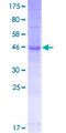 LHFPL4 Protein - 12.5% SDS-PAGE of human LHFPL4 stained with Coomassie Blue