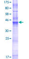LHFPL5 Protein - 12.5% SDS-PAGE of human LHFPL5 stained with Coomassie Blue