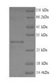 LHPP Protein - (Tris-Glycine gel) Discontinuous SDS-PAGE (reduced) with 5% enrichment gel and 15% separation gel.