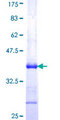 LHX1 Protein - 12.5% SDS-PAGE Stained with Coomassie Blue.