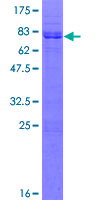 LHX2 Protein - 12.5% SDS-PAGE of human LHX2 stained with Coomassie Blue
