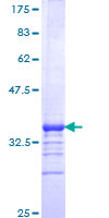 LHX2 Protein - 12.5% SDS-PAGE Stained with Coomassie Blue.