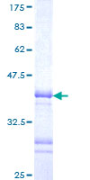 LHX3 Protein - 12.5% SDS-PAGE Stained with Coomassie Blue.