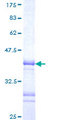 LHX3 Protein - 12.5% SDS-PAGE Stained with Coomassie Blue.