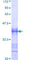 LHX4 Protein - 12.5% SDS-PAGE Stained with Coomassie Blue.