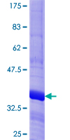LHX6 Protein - 12.5% SDS-PAGE Stained with Coomassie Blue.