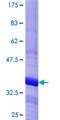 LHX6 Protein - 12.5% SDS-PAGE Stained with Coomassie Blue.