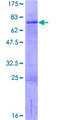 LHX9 Protein - 12.5% SDS-PAGE of human LHX9 stained with Coomassie Blue