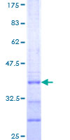 LHX9 Protein - 12.5% SDS-PAGE Stained with Coomassie Blue.