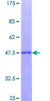 LIF Protein - 12.5% SDS-PAGE of human LIF stained with Coomassie Blue