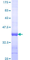 LIG3 / DNA Ligase III Protein - 12.5% SDS-PAGE Stained with Coomassie Blue
