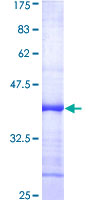 LIG4 / DNA Ligase IV Protein - 12.5% SDS-PAGE Stained with Coomassie Blue