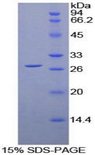 LILRA2 / CD85h / ILT1 Protein - Recombinant Leukocyte Immunoglobulin Like Receptor Subfamily A, Member 2 By SDS-PAGE