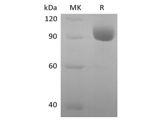 LILRA3 / CD85e Protein - Recombinant Human Leukocyte Ig-Like Receptor A3/LILRA3/ILT6/CD85e (C-Fc)