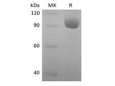 LILRA3 / CD85e Protein - Recombinant Human Leukocyte Ig-Like Receptor A3/LILRA3/ILT6/CD85e (C-Fc)