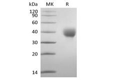 LILRA5 Protein - Recombinant Human Leukocyte Ig-Like Receptor A5/LILRA5/CD85f (C-6His-Avi) Biotinylated