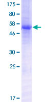 LILRA5 Protein - 12.5% SDS-PAGE of human LILRA5 stained with Coomassie Blue