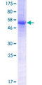 LILRA5 Protein - 12.5% SDS-PAGE of human LILRA5 stained with Coomassie Blue