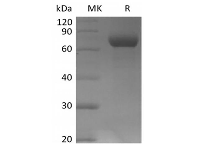 LILRB2 / ILT4 Protein - Recombinant Human Leukocyte Ig-Like Receptor B2/LILRB2/ILT4/CD85d (C-Avi-6His) Biotinylated