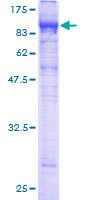 LILRB2 / ILT4 Protein - 12.5% SDS-PAGE of human LILRB2 stained with Coomassie Blue