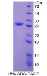 LILRB2 / ILT4 Protein - Recombinant Leukocyte Immunoglobulin Like Receptor Subfamily B, Member 2 By SDS-PAGE