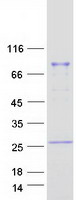 LIM Protein / LPP Protein - Purified recombinant protein LPP was analyzed by SDS-PAGE gel and Coomassie Blue Staining