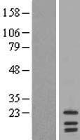 LIM2 Protein - Western validation with an anti-DDK antibody * L: Control HEK293 lysate R: Over-expression lysate
