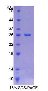 LIM2 Protein - Recombinant  Lens Intrinsic Membrane Protein 2 By SDS-PAGE