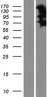 LIMCH1 Protein - Western validation with an anti-DDK antibody * L: Control HEK293 lysate R: Over-expression lysate