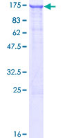LIMCH1 Protein - 12.5% SDS-PAGE of human LIMCH1 stained with Coomassie Blue