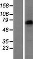 LIMD1 Protein - Western validation with an anti-DDK antibody * L: Control HEK293 lysate R: Over-expression lysate