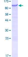LIMD1 Protein - 12.5% SDS-PAGE of human LIMD1 stained with Coomassie Blue