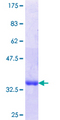LIMD1 Protein - 12.5% SDS-PAGE Stained with Coomassie Blue.