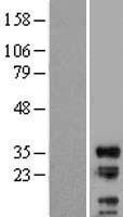LIME1 / LIME Protein - Western validation with an anti-DDK antibody * L: Control HEK293 lysate R: Over-expression lysate