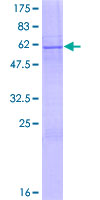 LIME1 / LIME Protein - 12.5% SDS-PAGE of human LIME1 stained with Coomassie Blue