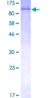 LIMK1 / LIMK Protein - 12.5% SDS-PAGE of human LIMK1 stained with Coomassie Blue