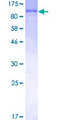 LIMK1 / LIMK Protein - 12.5% SDS-PAGE of human LIMK1 stained with Coomassie Blue