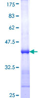 LIMK1 / LIMK Protein - 12.5% SDS-PAGE Stained with Coomassie Blue.