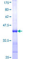 LIMK1 / LIMK Protein - 12.5% SDS-PAGE Stained with Coomassie Blue.