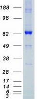 LIMK1 / LIMK Protein - Purified recombinant protein LIMK1 was analyzed by SDS-PAGE gel and Coomassie Blue Staining