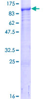 LIMK2 Protein - 12.5% SDS-PAGE of human LIMK2 stained with Coomassie Blue