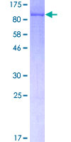 LIMK2 Protein - 12.5% SDS-PAGE of human LIMK2 stained with Coomassie Blue