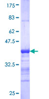 LIMK2 Protein - 12.5% SDS-PAGE Stained with Coomassie Blue.