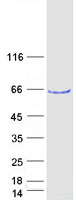 LIMK2 Protein - Purified recombinant protein LIMK2 was analyzed by SDS-PAGE gel and Coomassie Blue Staining