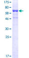 LIMPII / SCARB2 Protein - 12.5% SDS-PAGE of human SCARB2 stained with Coomassie Blue
