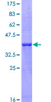 LIMPII / SCARB2 Protein - 12.5% SDS-PAGE Stained with Coomassie Blue.