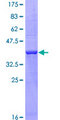 LIMPII / SCARB2 Protein - 12.5% SDS-PAGE Stained with Coomassie Blue.